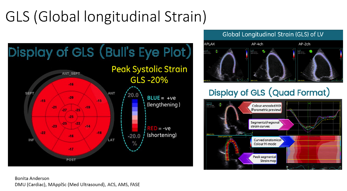global longitudinal strain