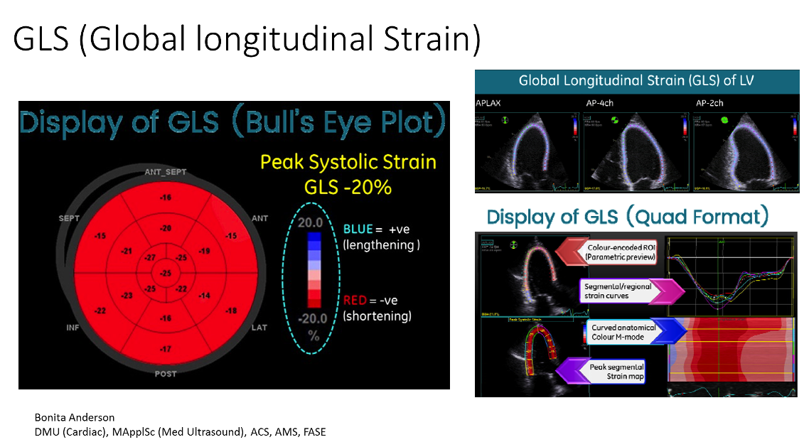 global longitudinal strain abnormal